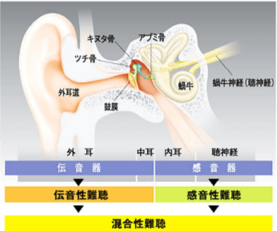 音の聞こえ方の変化説明画像